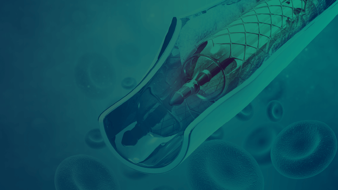 Novel Benchtop Tool Validates CM&S Stent Fracture Predictions: Case Study Webinar